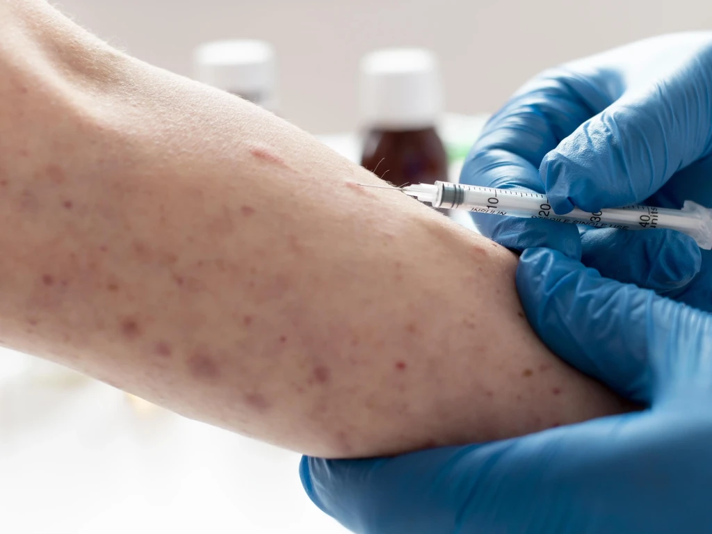 Kemenkes Ingatkan Waspada Campak Jelang Mudik Lebaran, Imunisasi Anak Jadi Kunci