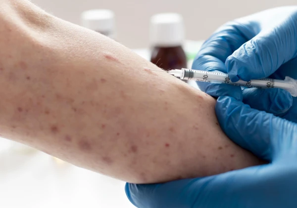 Kemenkes Ingatkan Waspada Campak Jelang Mudik Lebaran, Imunisasi Anak Jadi Kunci