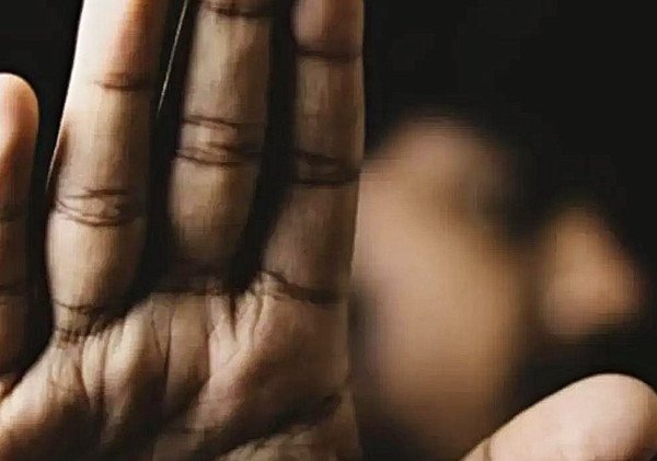 Kematian Bocah Sukabumi, Autopsi Temukan Luka Bakar